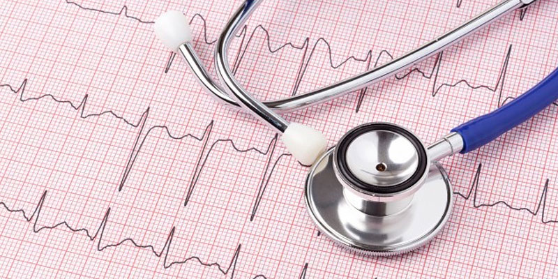 EKG